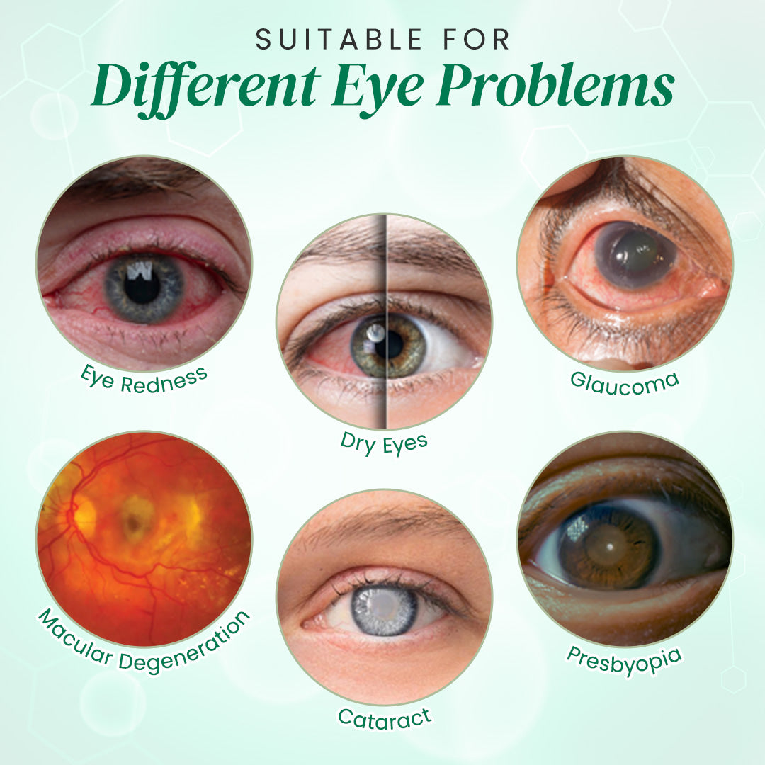 👩‍⚕️Seurico™ Nano Eye Drops Serum ✅Approved by the American Academy of Ophthalmology(Suitable for presbyopia, dry eye syndrome, glaucoma, and cataracts)