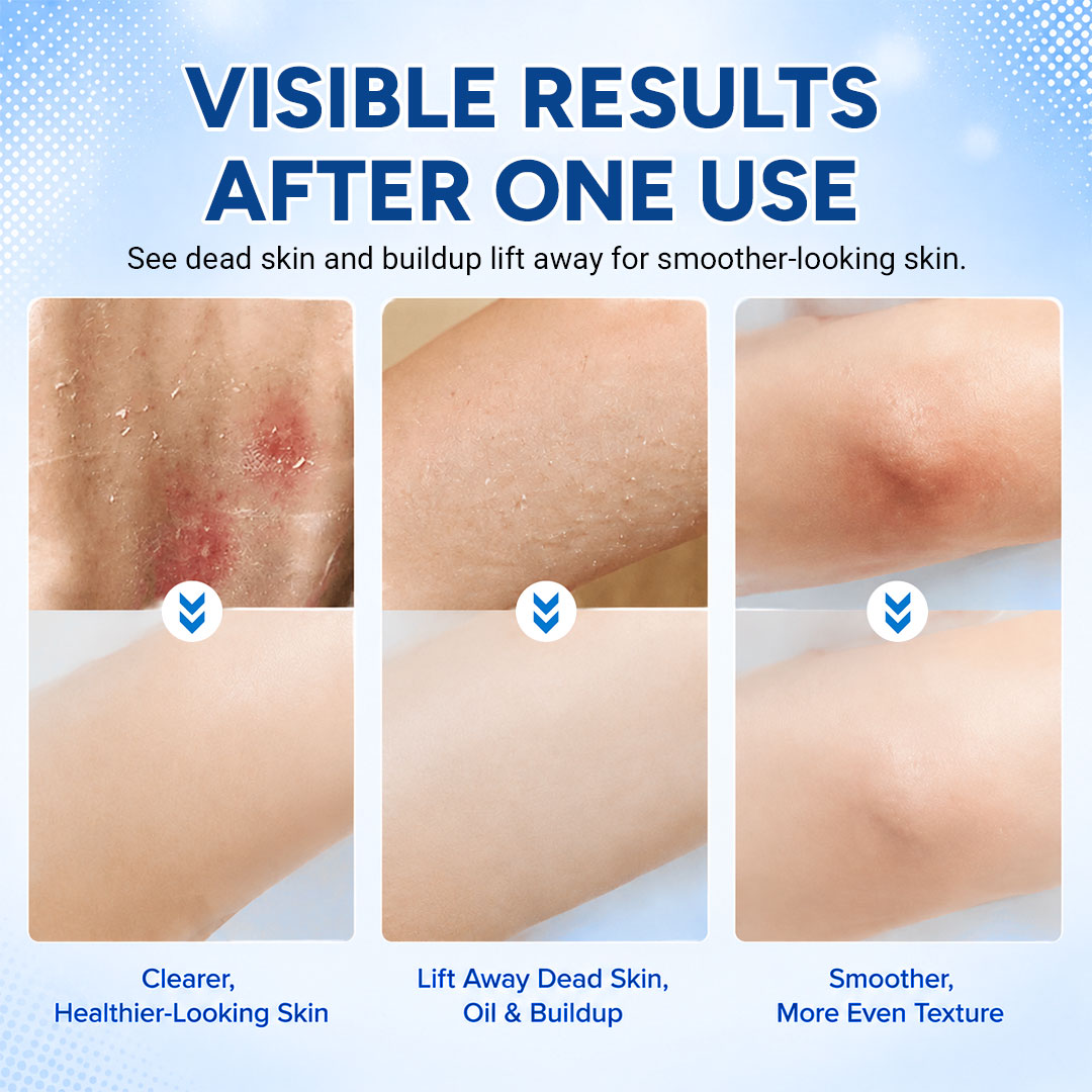 DEEP-EXFOLIATING BODY SCRUBBER