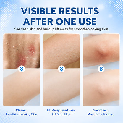 DEEP-EXFOLIATING BODY SCRUBBER