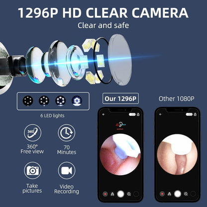Smart Ear Wax Cleaner with Camera
