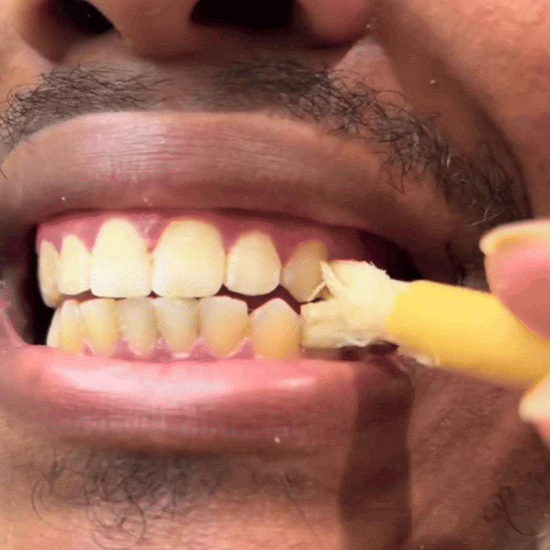 🌿 Miswak — Nature’s Original 7,000-Year-Old Toothbrush